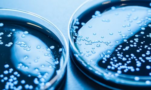 Legionellabacteriën op een petrischaaltje